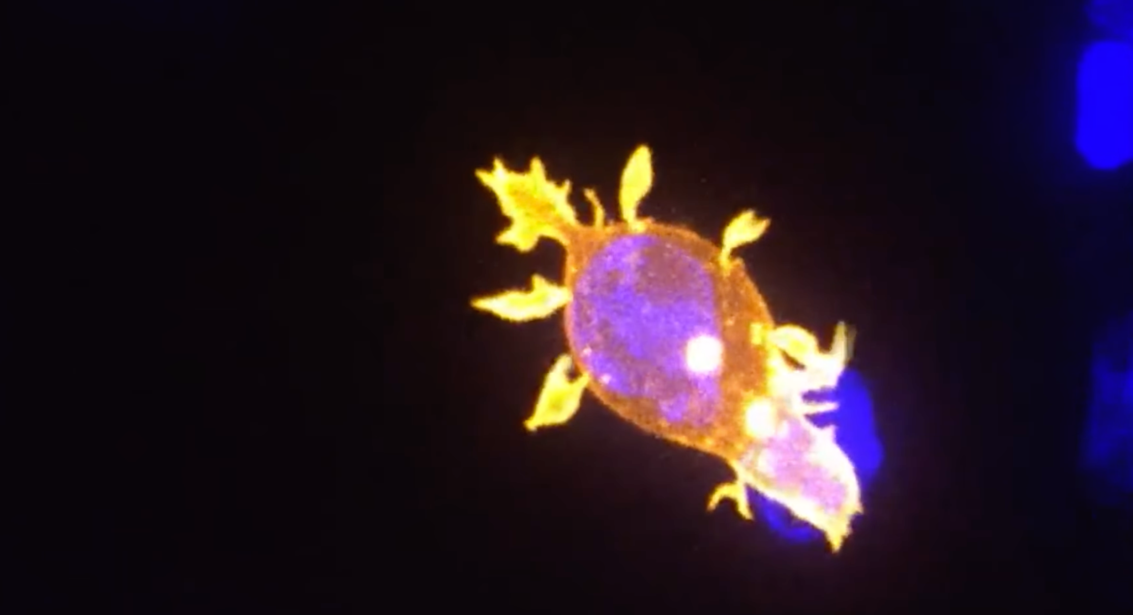 Scientists Create Cancer-Fighting Immune Cells Right in the Body
